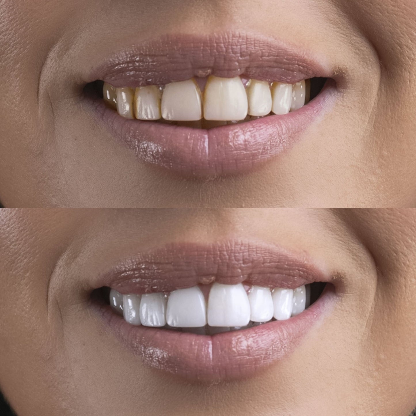 Advance Teeth Whitening Powder
Lab Tested • Enamel-Safe • Mineral Formula